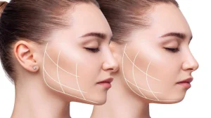 کلینیک نئوفیس متخصص جراحی فک و زیبایی در تهران فرمانیه