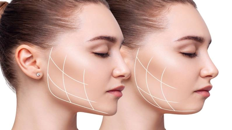کلینیک نئوفیس متخصص جراحی فک و زیبایی در تهران فرمانیه